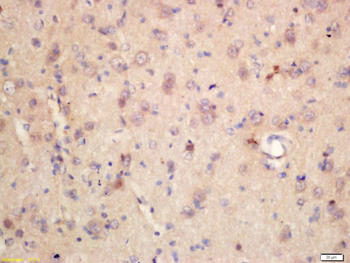 Bad Rabbit Polyclonal Antibody