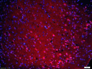 Bad Rabbit Polyclonal Antibody