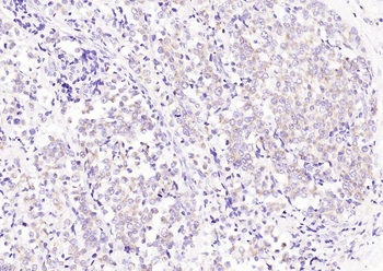 Phospho-BAD (Ser128) Rabbit Polyclonal Antibody