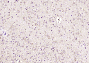 RAB8B Rabbit Polyclonal Antibody