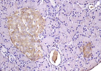 TMED4 Rabbit Polyclonal Antibody