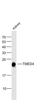TMED4 Rabbit Polyclonal Antibody