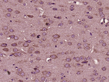 HRG beta 1 Rabbit Polyclonal Antibody