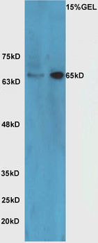 HRG beta 1 Rabbit Polyclonal Antibody