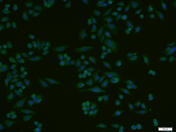 HRG beta 1 Rabbit Polyclonal Antibody