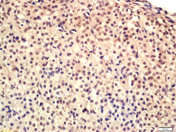 HRG beta 1 Rabbit Polyclonal Antibody