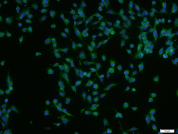 HRG beta 1 Rabbit Polyclonal Antibody