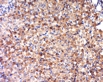 OVCA2 Rabbit Polyclonal Antibody