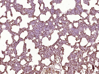 EZH1 Rabbit Polyclonal Antibody