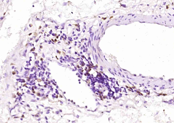 MAGEA12 Rabbit Polyclonal Antibody