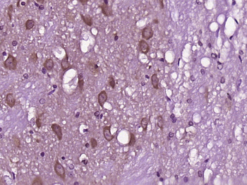 INPPL1 Rabbit Polyclonal Antibody