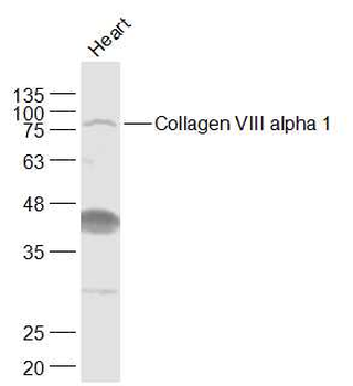 Collagen VIII alpha 1 Rabbit Polyclonal Antibody