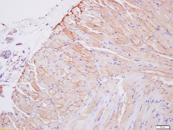 Collagen VIII alpha 1 Rabbit Polyclonal Antibody