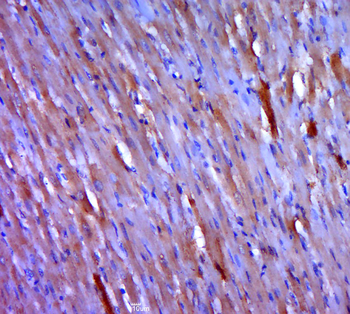 AT2A1/SERCA1 ATPase Rabbit Polyclonal Antibody