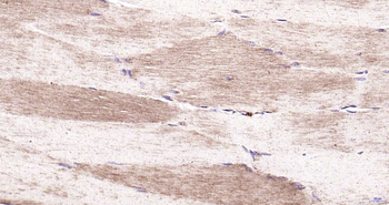 AT2A1/SERCA1 ATPase Rabbit Polyclonal Antibody