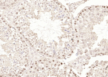 RNF36 Rabbit Polyclonal Antibody