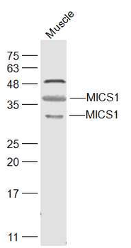 MICS1 Rabbit Polyclonal Antibody