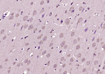 CIDE A Rabbit Polyclonal Antibody