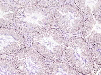 DATF1 Rabbit Polyclonal Antibody