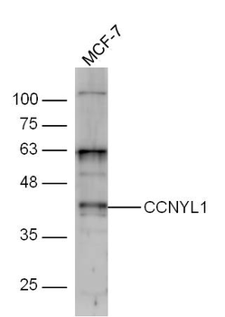 CCNYL1 Rabbit Polyclonal Antibody