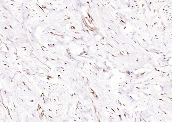 Phospho-CK II beta (Ser209) Rabbit Polyclonal Antibody