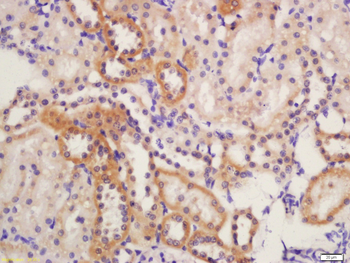 ALDH1L1 Rabbit Polyclonal Antibody