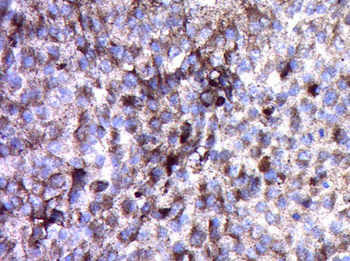 NG2 Rabbit Polyclonal Antibody