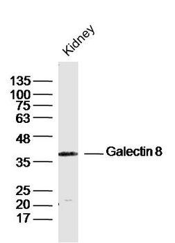 Galectin 8 Rabbit Polyclonal Antibody