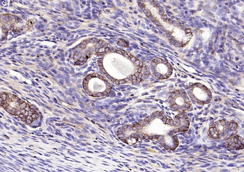 EpCAM Rabbit Polyclonal Antibody