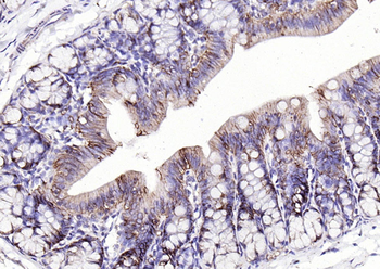 EpCAM Rabbit Polyclonal Antibody