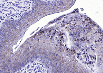 EpCAM Rabbit Polyclonal Antibody