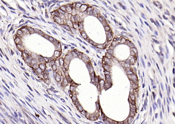 EpCAM Rabbit Polyclonal Antibody
