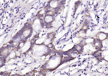EpCAM Rabbit Polyclonal Antibody