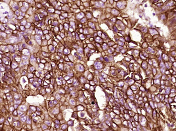 EpCAM Rabbit Polyclonal Antibody