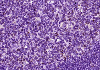 CD40/TNFRSF5 Rabbit Polyclonal Antibody