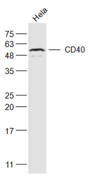 CD40/TNFRSF5 Rabbit Polyclonal Antibody