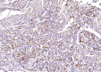 Angiopoietin-like 4 Rabbit Polyclonal Antibody