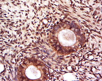 PBOV1 Rabbit Polyclonal Antibody