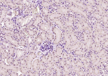 SMARCB1 Rabbit Polyclonal Antibody