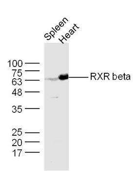 RXR beta Rabbit Polyclonal Antibody