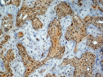 Osteocalcin Rabbit Polyclonal Antibody