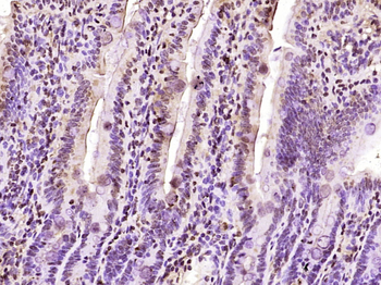 DRES17 Rabbit Polyclonal Antibody