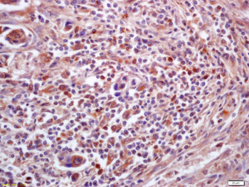 PPT1 Rabbit Polyclonal Antibody