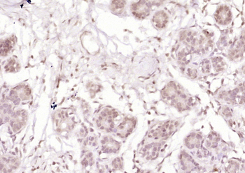 ID4 Rabbit Polyclonal Antibody