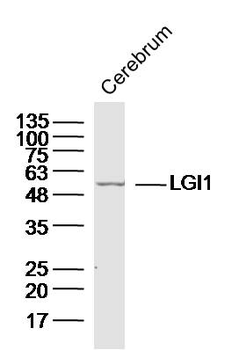 LGI1 Rabbit Polyclonal Antibody