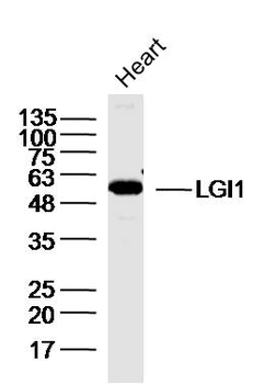 LGI1 Rabbit Polyclonal Antibody