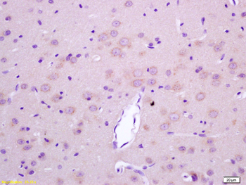 LGI1 Rabbit Polyclonal Antibody