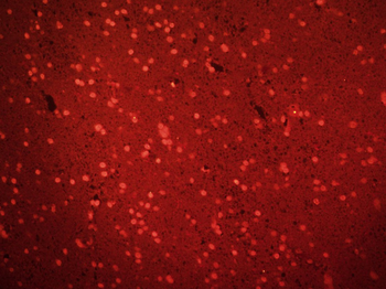 MAGEA2 Rabbit Polyclonal Antibody