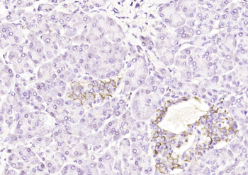 GBP5 Rabbit Polyclonal Antibody