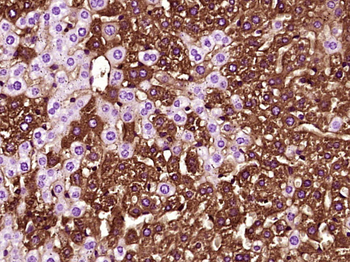 VEGFA Mouse Monoclonal Antibody